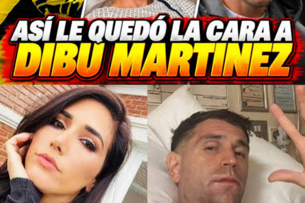 ¡IMPACTANTE! ASÍ QUEDÓ EL DIBU MARTÍNEZ TRAS EL TREMENDO CHOQUE QUE PA...